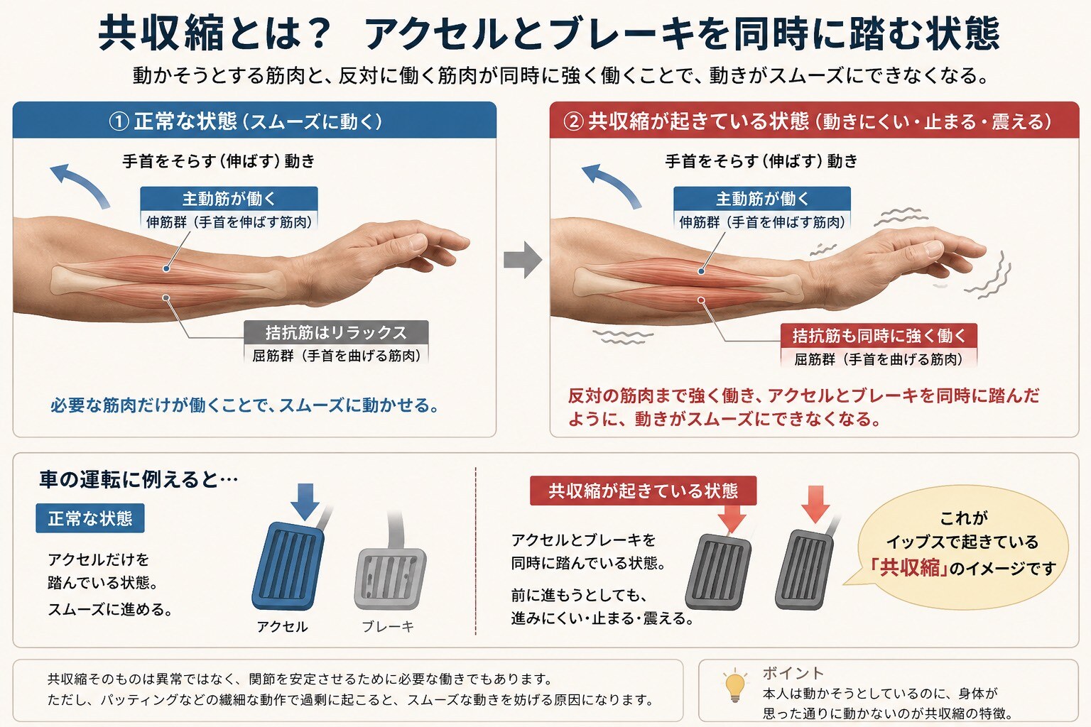 共収縮とは？アクセルとブレーキを同時に踏む状態を示した図
